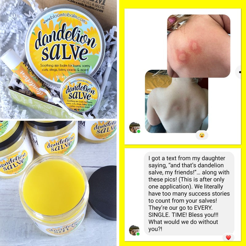 DANDELION Salve {Original Formula}